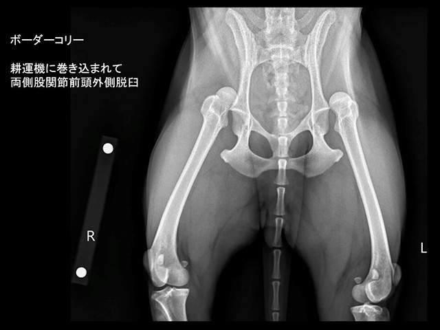 股関節脱臼